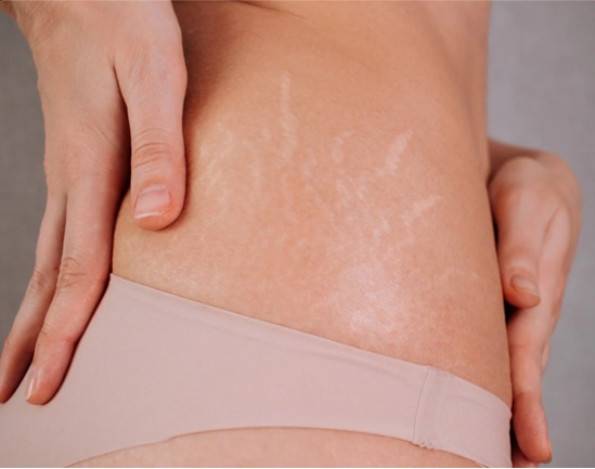 Conversa médica sobre a decisão de fazer Lipo HD