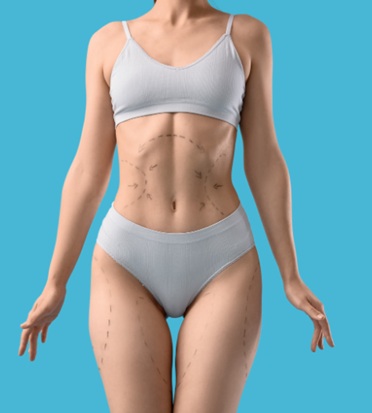 Mulher avaliando mudanças no abdômen antes de considerar uma abdominoplastia